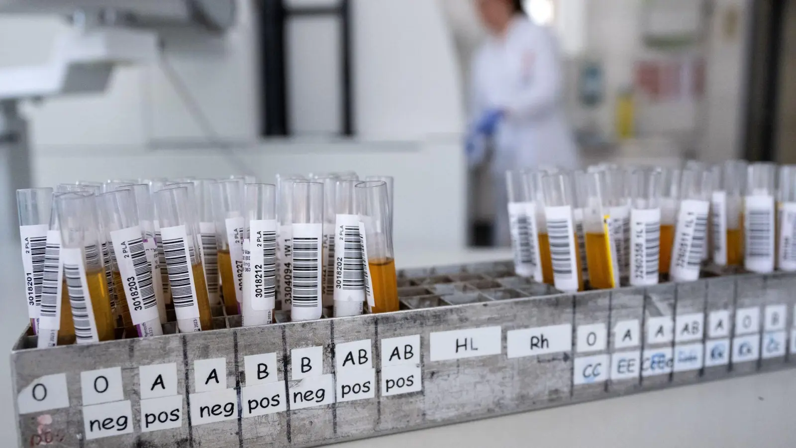 Blut ist nicht gleich Blut: Entscheidend für die Einsortierung in eine Blutgruppe ist, welche Antigene sich auf der Hülle der roten Blutkörperchen befinden. (Foto: Sven Hoppe/dpa/dpa-tmn)