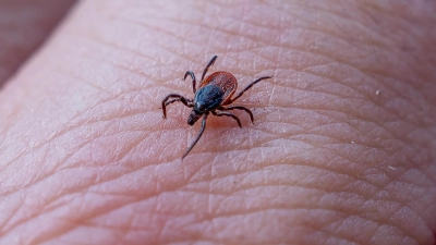 Sie lauern gerne im Grünen: Zecken. Wer nach jedem Aufenthalt seinen Körper absucht, erhöhte die Chance, das Exemplar noch laufend, wie auf unserem Foto, zu erwischen, bevor es sich festbeißt. (Foto: Mirko Fryska)