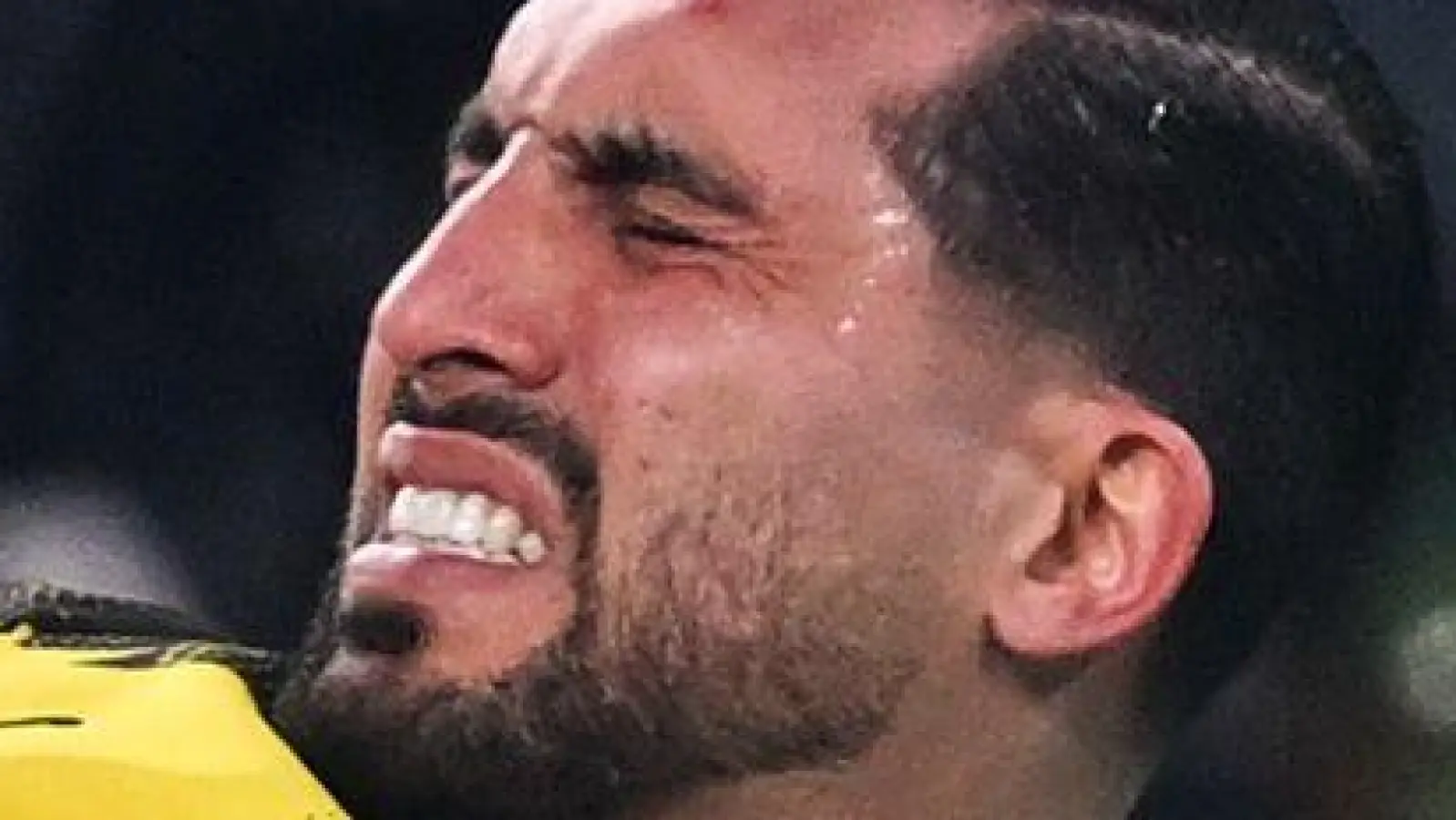 Borussia Dortmunds Kapitän Emre Can fällt lange aus. (Foto: David Inderlied/dpa)