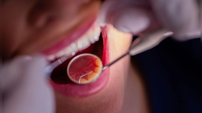 Zahnarztbehandlungen sollen nach dem Willen des CDU-Wirtschaftsrats „nicht länger im Umlageverfahren den Beitragszahlern zur Last fallen“. (Symbolbild) (Foto: Rolf Vennenbernd/dpa)