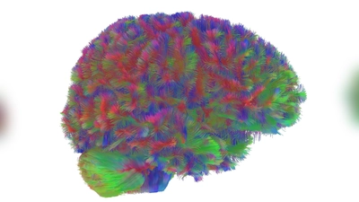 Sogenannte MRT-Diffusionsscans lassen deutliche Unterschiede der Hirnstruktur abhängig vom Alter erkennen. (Foto: Dr Alexa Mousley/University of Cambridge/dpa)