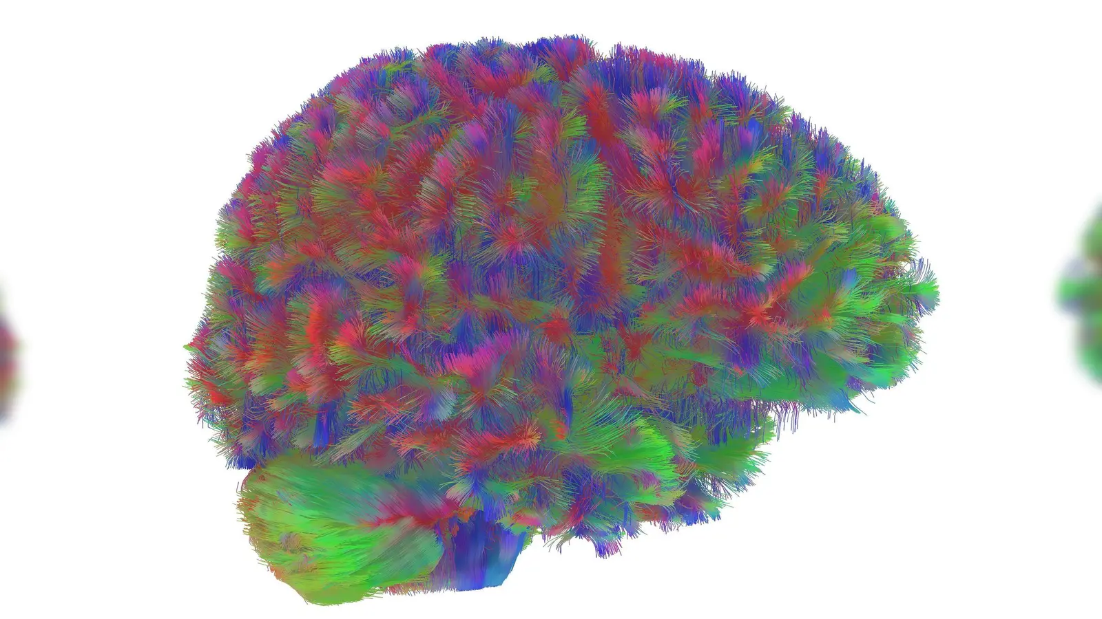 Sogenannte MRT-Diffusionsscans lassen deutliche Unterschiede der Hirnstruktur abhängig vom Alter erkennen. (Foto: Dr Alexa Mousley/University of Cambridge/dpa)