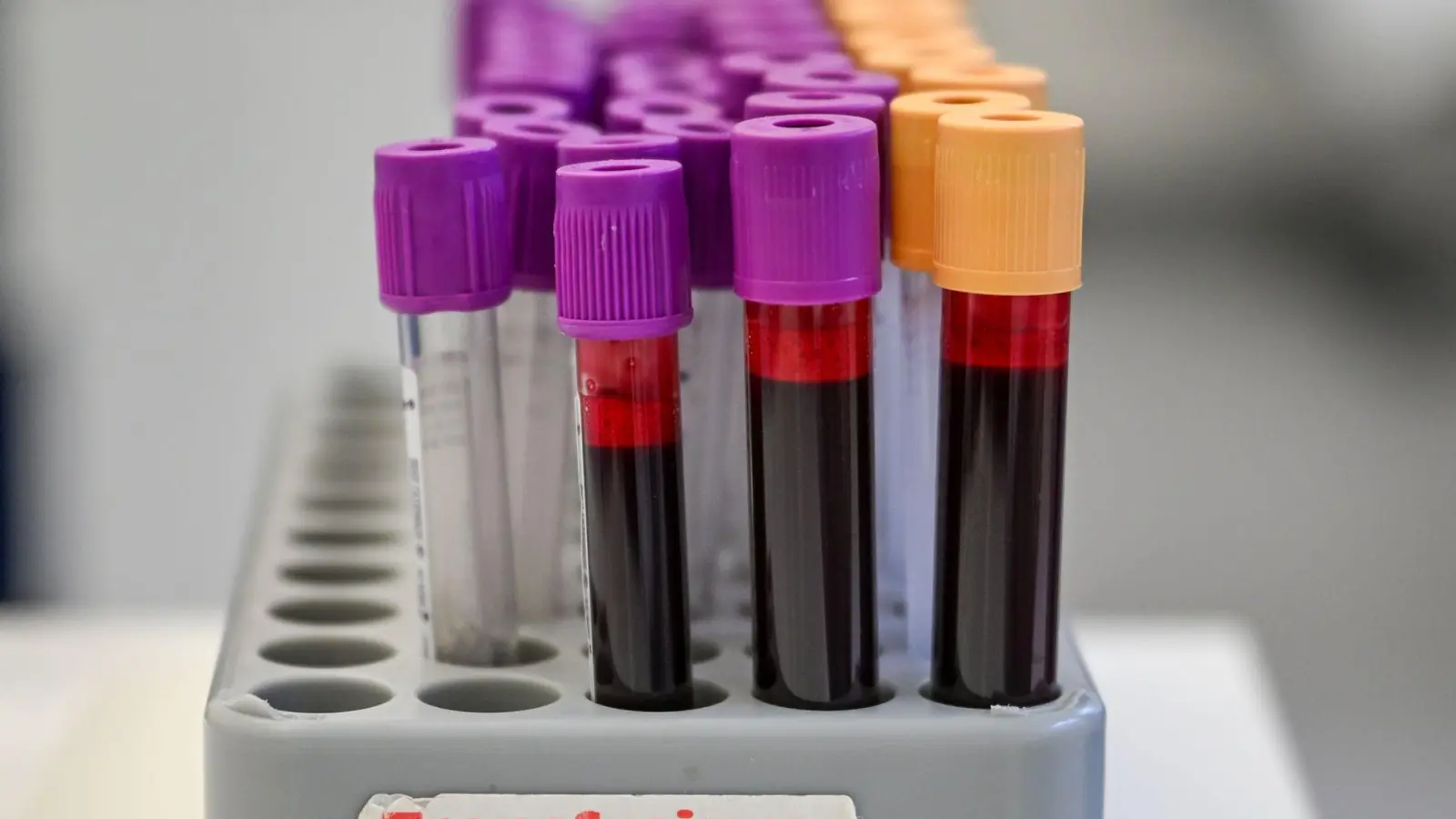 Eine Blutspende kann bis zu drei Menschen helfe (Symbolbild). (Foto: Jens Kalaene/dpa)