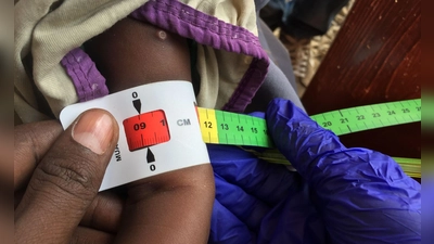Ein Arzt misst im Sudan den Armumfang eines schwer unterernährten Babys (Archivbild) (Foto: Eva-Maria Krafczyk/dpa)