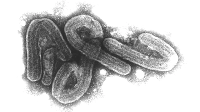 Eine elektronenmikroskopische Aufnahme des Marburg-Virus. (Archivbild) (Foto: Bernhard-Nocht-Institut/dpa)