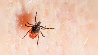 Der Gemeine Holzbock ist die häufigste Zeckenart in Deutschland und auch die, die hauptsächlich FSME und Borreliose auf den Menschen übertragt. (Archivbild) (Foto: Patrick Pleul/dpa)