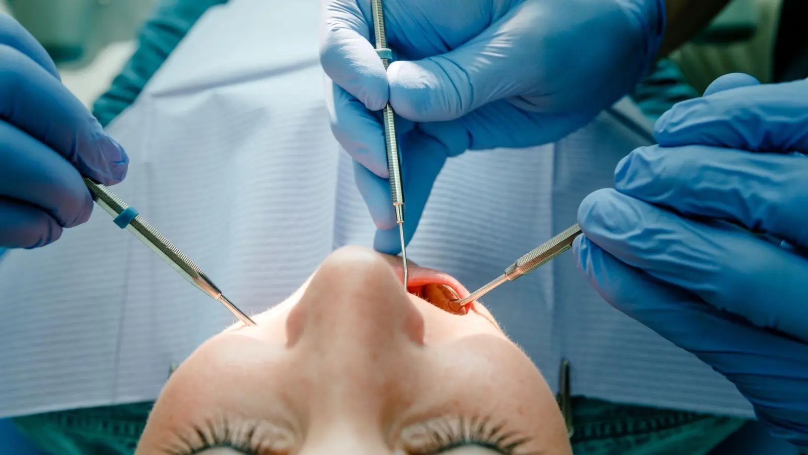 Machen die Weisheitszähne Probleme, müssen sie raus - ein Termin, vor dem viele Betroffene Angst haben.  (Foto: Markus Scholz/dpa-tmn)