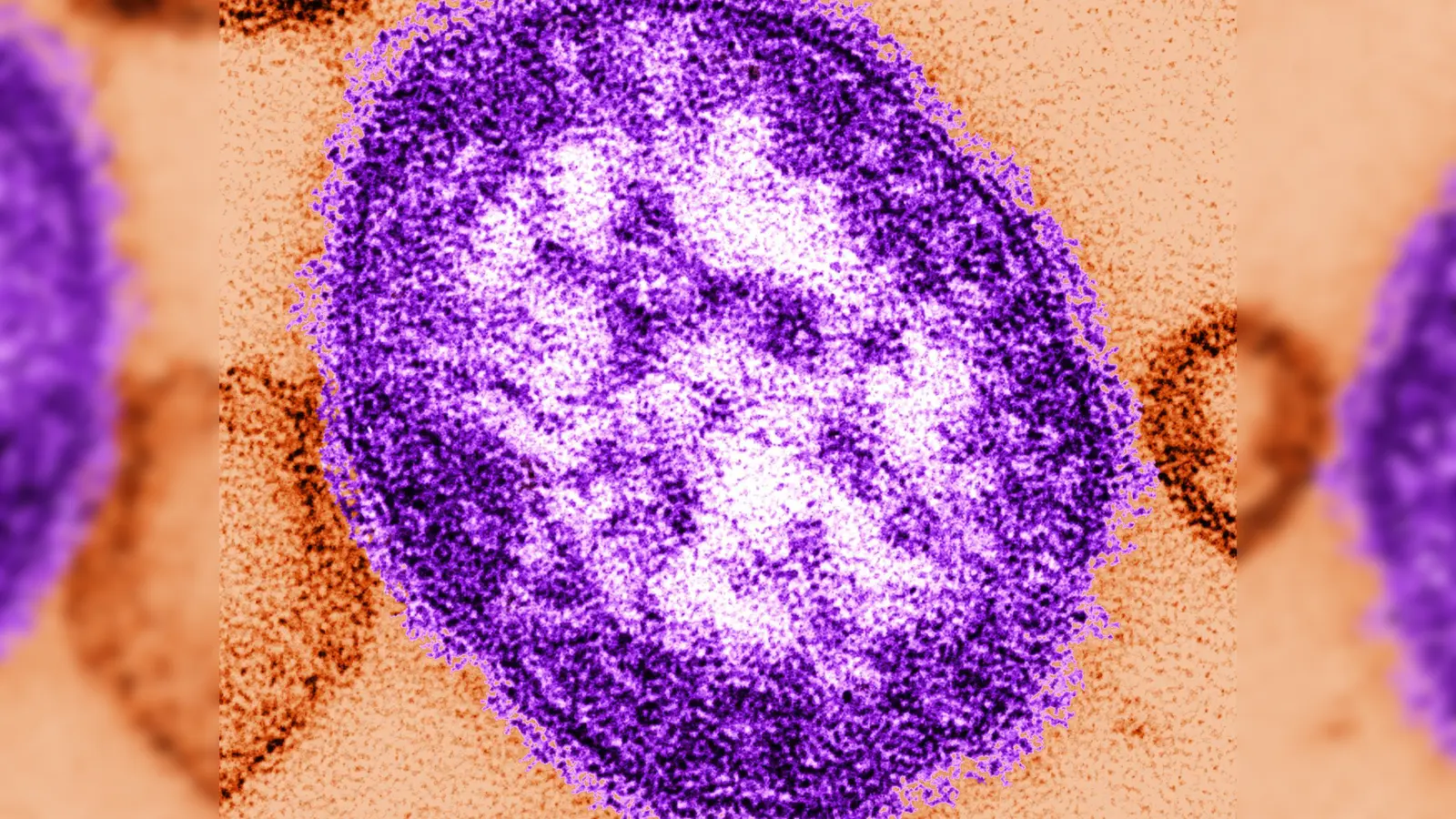 In den USA wurden seit Anfang des Jahres fast 1000 Masern-Fälle gemeldet. (Foto: Cynthia Goldsmith/Centers for Disease Contról and Prevention/dpa)