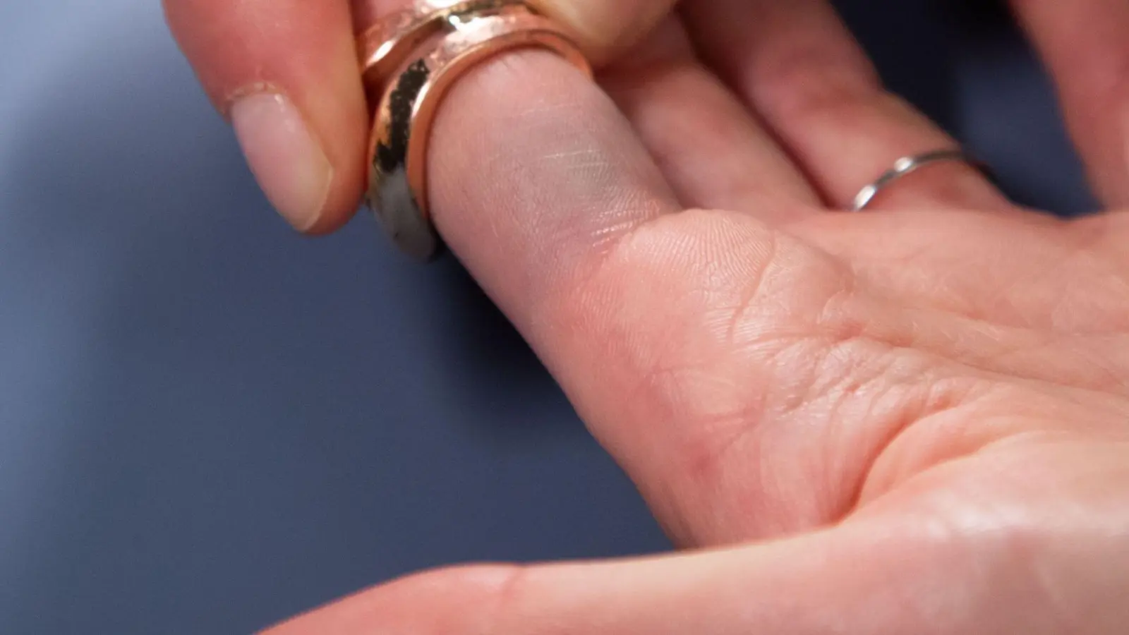 Blaue Ränder durch Modeschmuck? Ein Lifehack soll das verhindern. (Foto: Christin Klose/dpa-tmn)