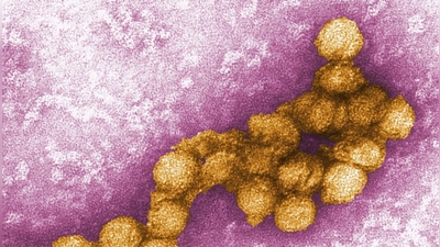 So sieht das West-Nil-Virus unter dem Elektronenmikroskop aus. (Archivbild) (Foto: Cynthia Goldsmith/CENTERS FOR DISEASE CONTROL/EPA/dpa)