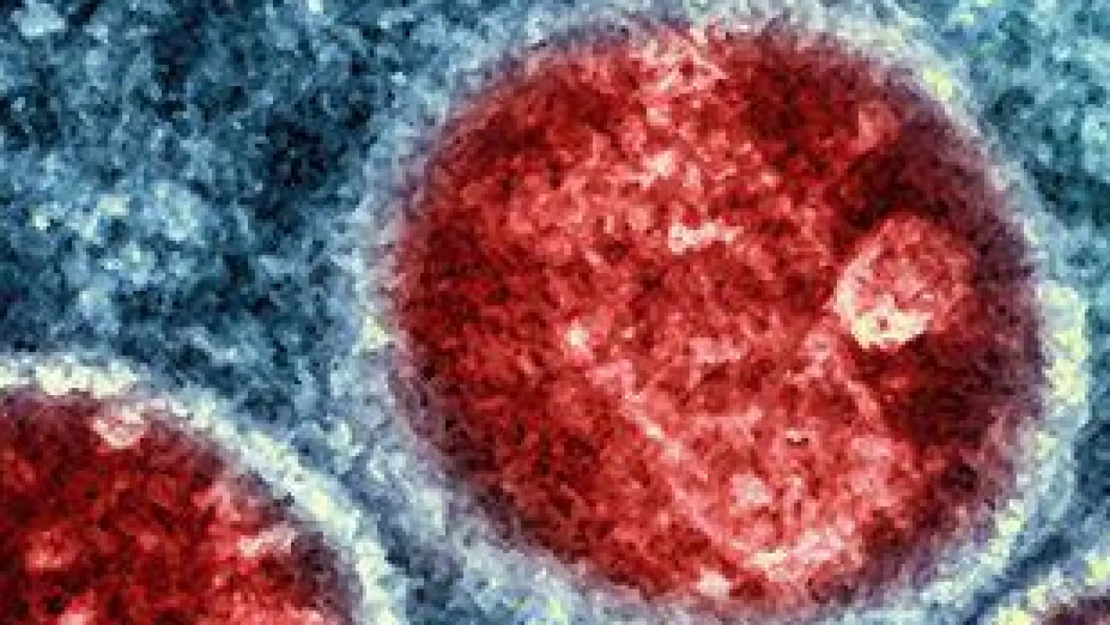  Beim Menschen wurden Mpox erstmals 1970 in der Demokratischen Republik Kongo identifiziert (Symbolbild). (Foto: -/National Institute of Allergy and Infectious Diseases/dpa)