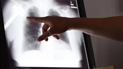 Über die Landesärztekammern kann man ein kostenloses Verfahren bei Gutachterkommissionen und Schlichtungsstellen einleiten, die eine ärztliche und juristische Bewertung des Falls vornehmen.  (Foto: Susann Prautsch/dpa/dpa-tmn)