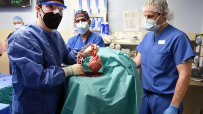 Ärzte operierten an einem Schweineherz, das in einen menschlichen Patienten eingesetzt wurde. Nun ist der Transplantationspatient gestorben. (Foto: Tom Jemski/University of Maryland School of Medicine/dpa)